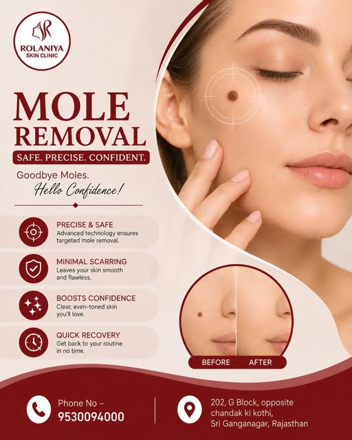 That mole bothering you? It may be time for a change. ✨

Mole removal can help improve the appearanc