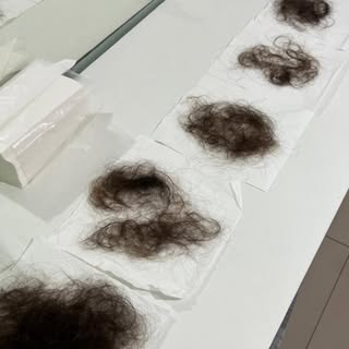 Queda capilar não é algo que você precisa aceitar.

Cada paciente tem uma história, e esse é o relat