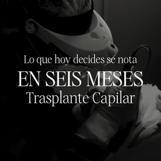 Un trasplante capilar no es inmediato, pero sí progresivo y planificado.

Los cambios comienzan a no