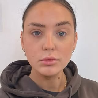 ubtle changes, refreshed results ✨

Botox can help soften the appearance of expression lines while k