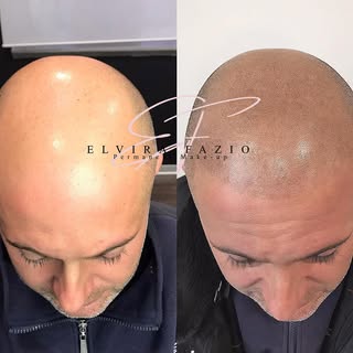 TRICOPIGMEMTAZIONE EFFETTO RASATO 
#tricopigmentazione #tricologia #hairstyle #men #torino #milano #