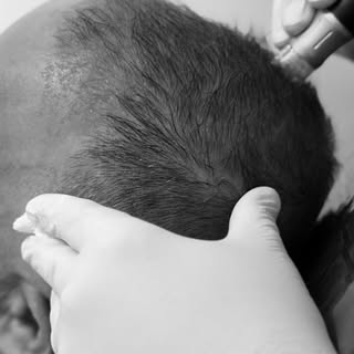 O tratamento não recupera só cabelo, recupera autoestima e confiança. Largar o boné nunca foi tão fá