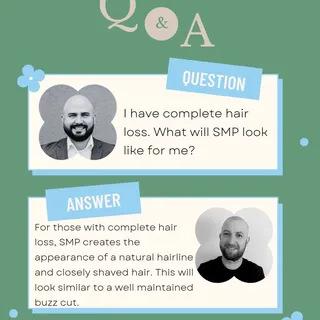 I have complete hair loss. What will SMP look like for me? 🤔 

For those with complete hair loss, S