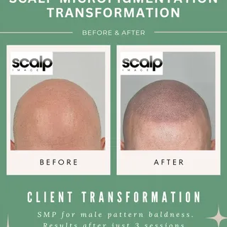 Look at this transformation! 👀🔥 

This client came to us hoping to restore the look of a fuller he