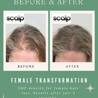 A subtle transformation with a big impact. ✨️ 

This client was struggling with her thinning hairlin