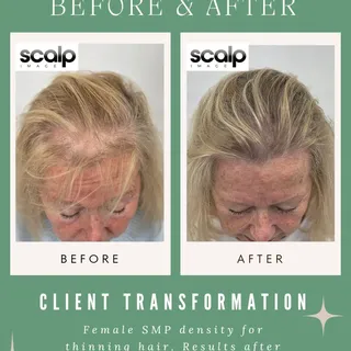 Struggling with thinning hair? 

This lady was unhappy with her hair loss and was struggling to find