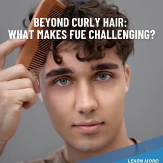 🌟Beyond Curly Hair: What Makes FUE Challenging?🌟

For years, curly hair has been considered one of
