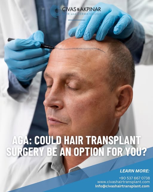 🌟AGA: Could Hair Transplant Surgery Be an Option for You?🌟

Hair loss is a common concern affectin