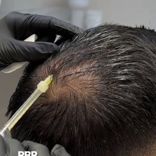Is your hair falling out every time you touch it? 😟

Still relying only on shampoos for hair fall?

