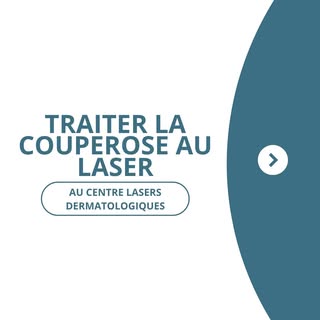 🔴 Couperose, érythrocouperose, rougeurs du nez et des joues : quel traitement ?

La couperose est u