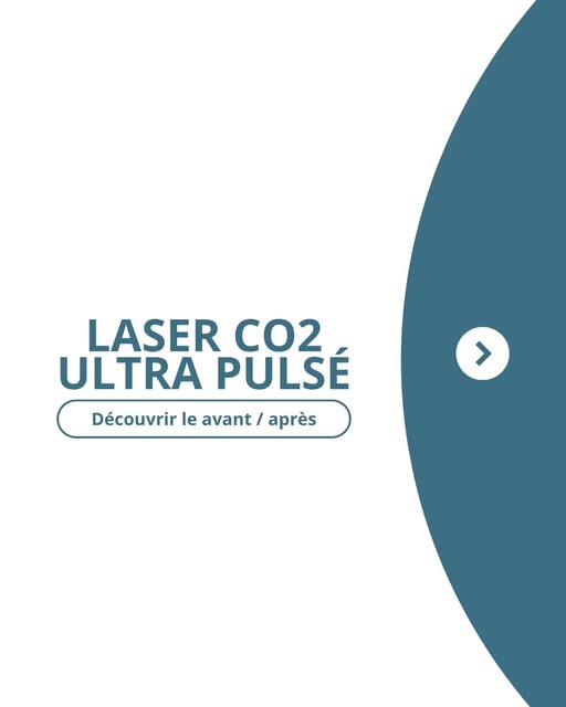 Le resurfacing au laser CO₂ ultra-pulsé permet d’agir en profondeur sur la qualité de la peau afin d