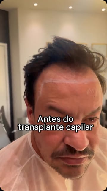Naturalidade é quando o resultado chama atenção pela harmonia — e não pelo procedimento.

Neste ante