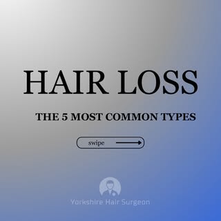 Here are 5 common causes of hair loss that might be affecting you.

Understanding the cause is the f