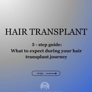 Thinking about a hair transplant? Here’s what the typical journey looks like—step by step. From cons