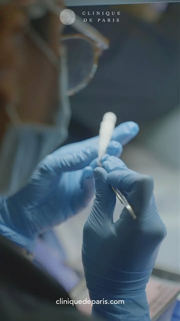 Not all hair transplants are performed the same way.

Follicular Unit Extraction (FUE) creates recip