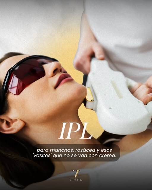 ✨ Una piel más uniforme y luminosa comienza con IPL.

📲 Agenda tu cita en Vitto MD.
📞 305-274-3393