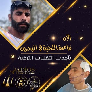 الخبرة التركية الان في البحرين زراعة الحد الاقصى لبصيلات الشعر باحدث التقنيات لمزيد من المعلومات  يم
