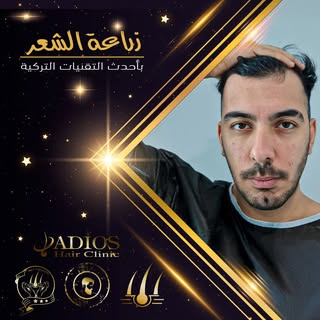 🌟 غير مظهرك مع تصميم خط الجبهة بشكل احترافي و طبيعي! 🌟
يُعد تصميم خط الجبهة بعناية أمراً أساسياً ل