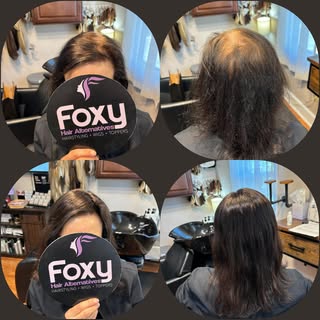 Toppers can change your life  #jonrenau #toppers #wigs #hairlosssolution #ilovemyjob