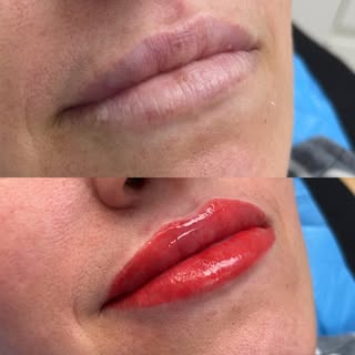 Adding depth of colour to the lips is my fav! ❤️

#lipblush #liptattoo #redlips #permanentmakeup