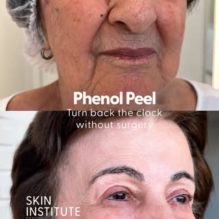 Turn back the clock—without surgery.
If you are looking for dramatic skin rejuvenation, you don’t ne