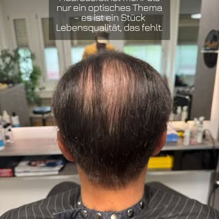 Haarausfall ist oft eine emotionale Belastung, die weit über das Äussere hinausgeht. Es kostet tägli
