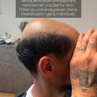 Haarausfall betrifft nicht nur das Aussehen, sondern oft auch das Selbstbewusstsein.

Deshalb steht 