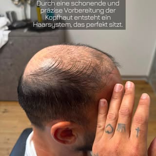 Ein neues Haarsystem ist mehr als Handwerk. 
Es bedeutet neues Selbstvertrauen, mehr Lebensqualität 