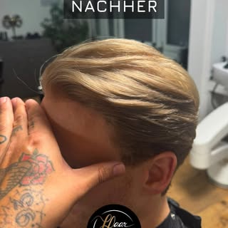 Lichtes Haar oder zurückweichende Haaransätze beeinträchtigen oft weit mehr als nur das äussere Ersc