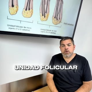 ¿Sabías que no se trasplantan “cabellos”… sino unidades foliculares? 👀 Un cabello es lo que ves. La