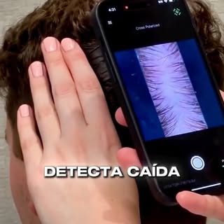 ¿Sabías cuántos cabellos estás perdiendo realmente? 🤨🔍
No adivines más. Con nuestra tecnología Hai