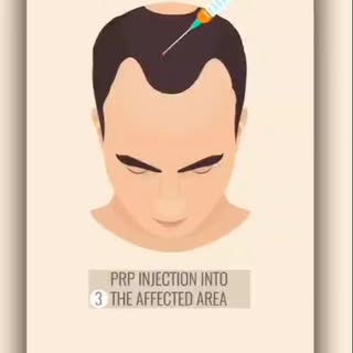 Book your session now 
#vardaanskinclinic #prptreatment #dermatologist #hair #skinclinic