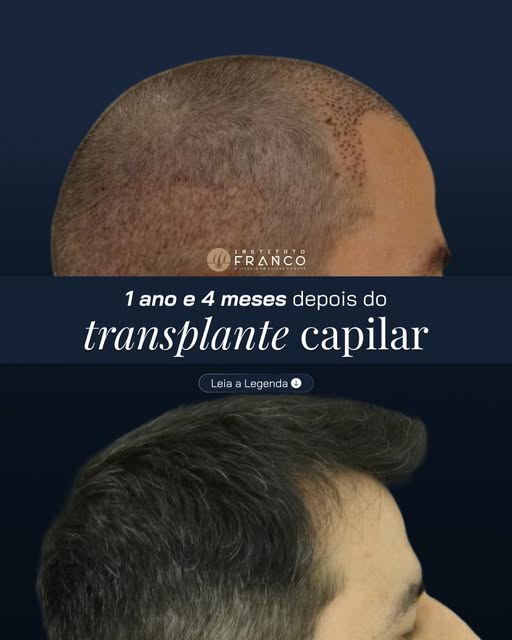 Cada resultado é de um caso específico, mas a pergunta que mais recebo é sempre a mesma: "isso funci