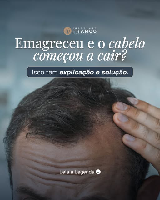 Emagreceu e o cabelo começou a cair? Isso tem explicação e solução.

Depois de uma perda de peso imp