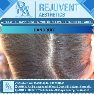 Reason for dandruff......... Rejuvent Aesthetics 
.
.
.
.
.
.
.
Contact us for More details 
.
.
.
.