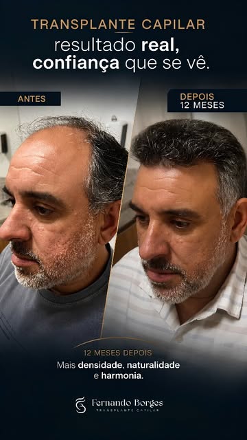 Nem todo grau 6 pode ser resolvido com apenas uma cirurgia. E esse é um detalhe que muita gente omit