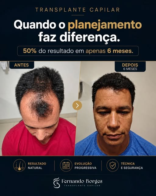 Nem sempre é a quantidade de fios que faz a diferença. Muitas vezes, é o planejamento.

Neste caso, 