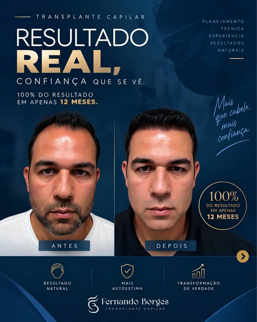 12 meses. 100% do resultado. Uma transformação que pode ser vista de todos os ângulos. 🔥

Esse caso