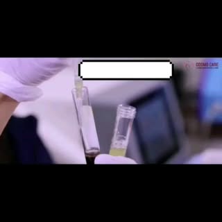 PRP(platelet rich plasma) with Microneedling  popularly known as VAMPIRE FACIAL helps to reduce fine