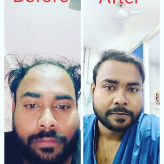 permanent solution of baldness.....best treatment of your hairless area & looks your age will decrea