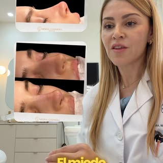¿Te da miedo la rinoplastia? Es completamente normal sentir dudas antes de dar un paso tan important