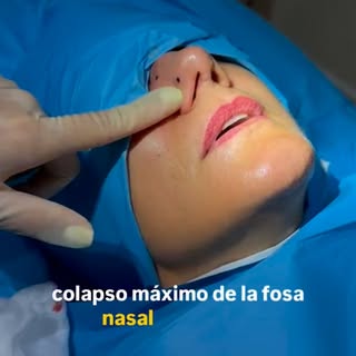 ¿Tu nariz se hunde cada vez que coges aire? Esto no es normal… y tiene solución. 😮‍💨

Cuando la zo