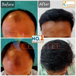 ✨ Real Results. Real Confidence. ✨
Swipe ⬅️ to see the incredible transformation!

Our client achiev