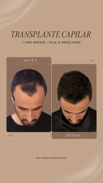 Nada nos deixa mais felizes do que ver nossos pacientes realizados e seguros com o próprio visual. 
