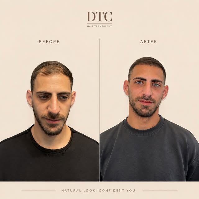 THE DIFFERENCE IS IN THE DETAILS.

קו שיער שתוכנן להתאים לפנים,
צפיפות שנבנתה נכון ותוצאה שמרגישה טב