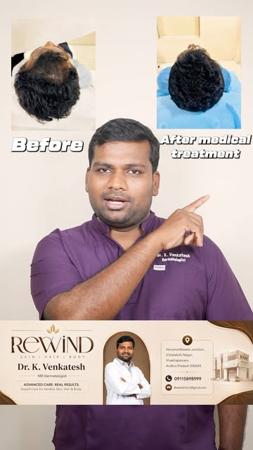 🧑‍⚕️ **Gents Hair Loss: Don’t Ignore the Signs!** 🧑‍⚕️

Hair loss in men can have different causes