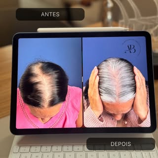 Nem todo paciente precisa de cirurgia.

Nesse caso, a estratégia foi a associação do tratamento clín