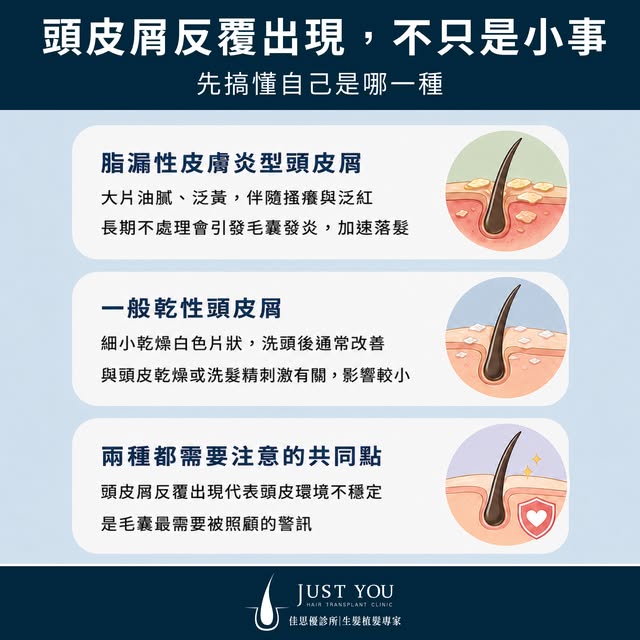 頭皮屑，只是乾燥問題？
不一定，有時候它在告訴你更嚴重的事

🔹 一般乾性頭皮屑
細小、白色乾燥片狀
頭皮不太癢，洗頭後改善
通常與季節乾燥或洗髮精刺激有關

🔹 脂漏性皮膚炎
大片油膩黃白色頭皮