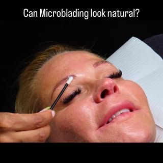 Absolutely. When done correctly, microblading mimics real brow hairs for a soft, natural enhancement