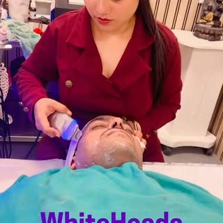 No more whiteheads…..😊